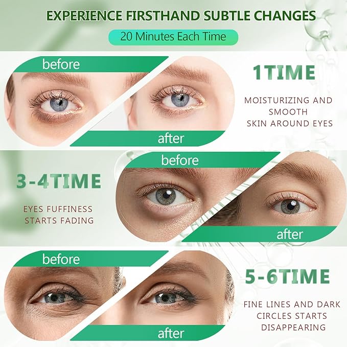 60 Pcs Green Under Eye Patches with 5 Pieces Travel 24K Gold Eye Mask, 30 Pairs Undereye Mask for Dark Circles Puffy Eye Treatment, Collagen Gel Pads Hydrating for Eye Bag Puffiness Wrinkle-BrightBean Baby