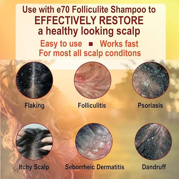 Folliculitis Treatment Hair Conditioner | Moisturize Sensitive Skin, Itchy, Dry Scalp & Damaged Hair Repair | Herbal Extracts for Soft, Shiny Hair | Gentle Color-Safe Detangling Solution-BrightBean Baby