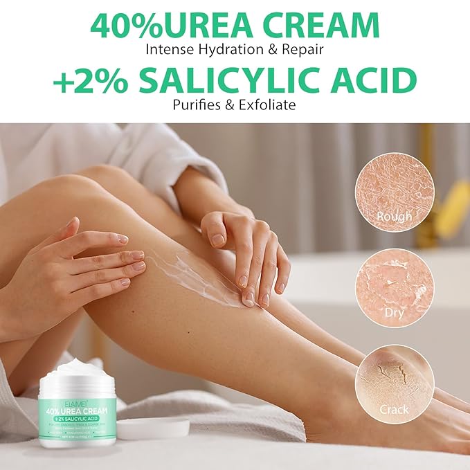 J&H Jasmine&Hyacinth 40% Urea Cream with 2% Salicylic Acid, Aloe, Feet/Heel Cream Moisturizer for Dry Cracked Heel, Knees, Elbows, Hands, Callus Remover, Intensive Hydrating Treatment-5.3 OZ/150 G-BrightBean Baby