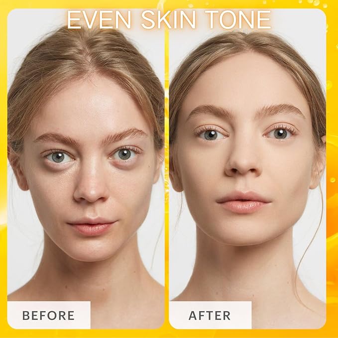 Vitamin C Skincare Set, 5Pcs Skincare Gift Set With Cleanser, Toner, Face Serum, Face Cream, And Eye Cream, Facial Kit for Women, 5-In-1 Skin care Gift Set, Moisturizing Skincare Set For Women Men-BrightBean Baby