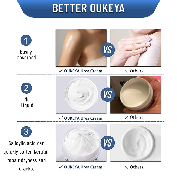 OUKEYA Urea Cream 42% plus Salicylic Acid 2% Net 5.29 Oz for Dry Cracked Feet,Heels,Knees,Elbows,Hands Repair Treatment Moisturizes and Removes Corns,Calluses,Dead Skin,and Softens Toenails-BrightBean Baby
