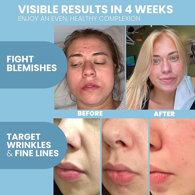 Eva Naturals Retinol Serum for Face – Anti Aging Night Serum with Hyaluronic Acid, Vitamin E, Witch Hazel, Aloe – Wrinkle Moisturizer, Dark Spot Corrector, Acne Scar Treatment, Skin Brightening – 2oz-BrightBean Baby