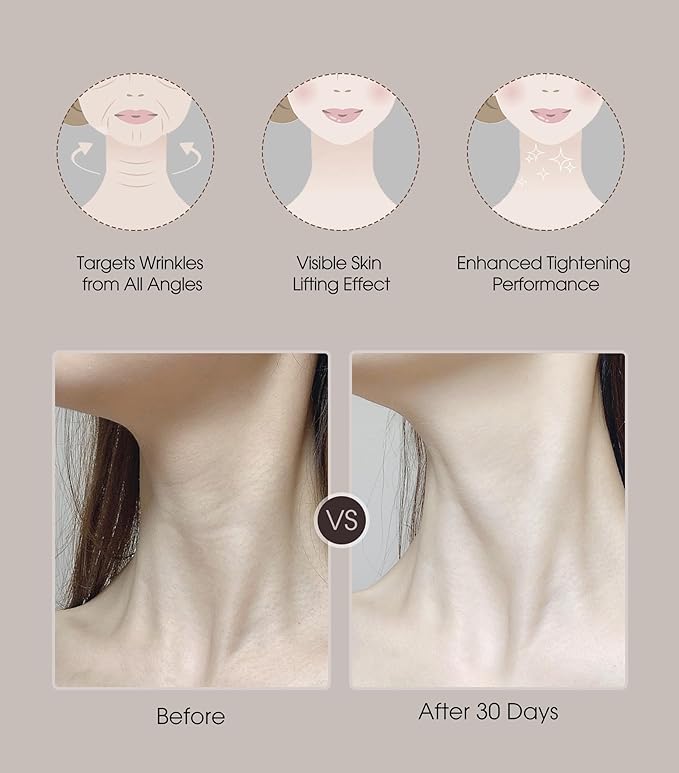 Intelligent Neck Lifting Device, 3 Color LED Neck Massager with Remote Control for Facial Massager | at Home Skin Care Tool-BrightBean Baby