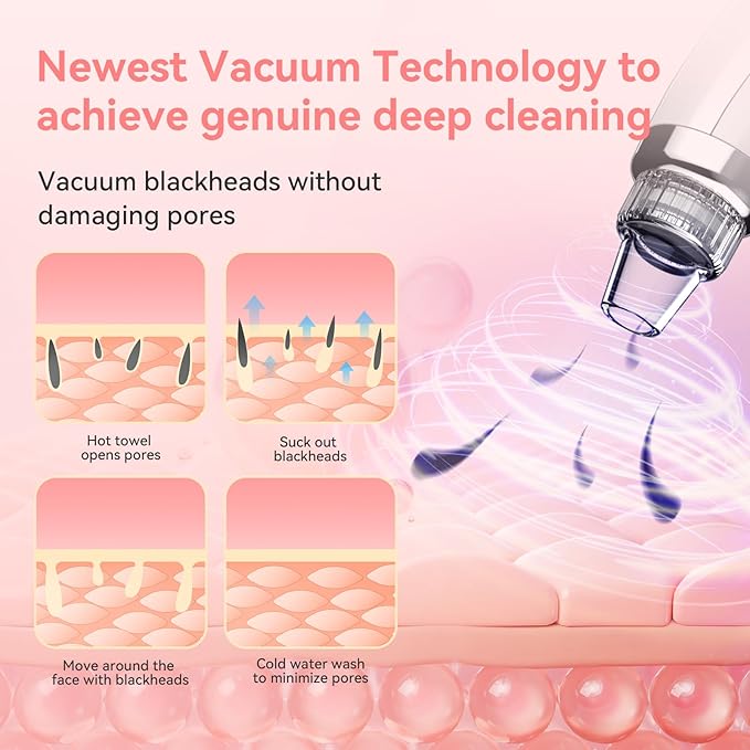 Blackhead Remover Pore Vacuum Upgraded Facial Pore Cleaner Electric Comedone Whitehead Extractor Tool-5 Suction Power,5 Probes,USB Rechargeable Blackhead Vacuum Kit for Women & Men-BrightBean Baby