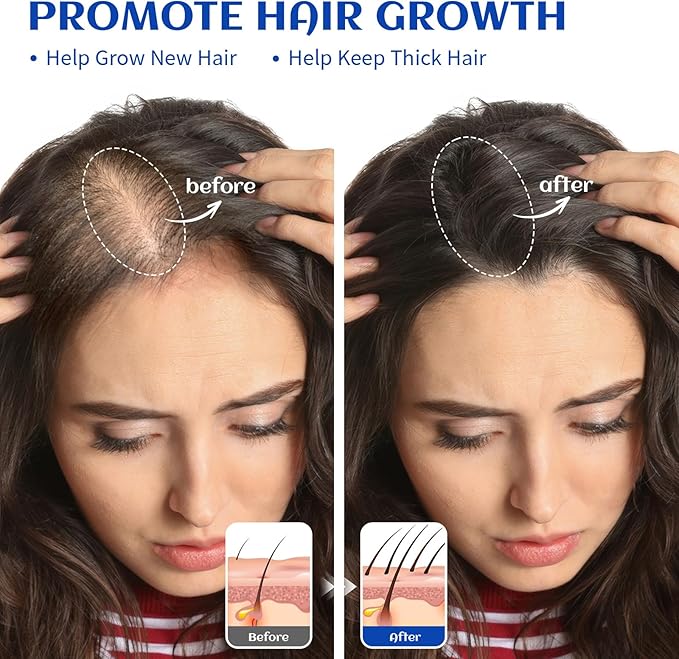 HIQILI 1000ML Rosemary Oil for Hair Growth, Add to Shampoo & Conditioner, 100% Pure Undiluted - 32 Fl Oz-BrightBean Baby