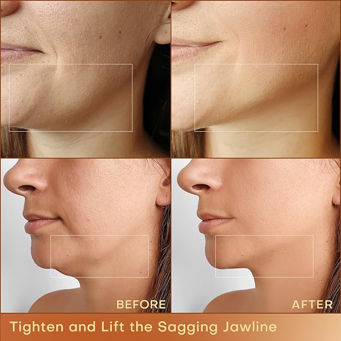 MLAY Professional RF Beauty Machine, Radio Frequency Face Machine with 2 Probes, at Home Radio Frequency Skin Tightening for Lifting, Wrinkle Reducing, Anti Aging - Salon Effects（Gel Included）-BrightBean Baby