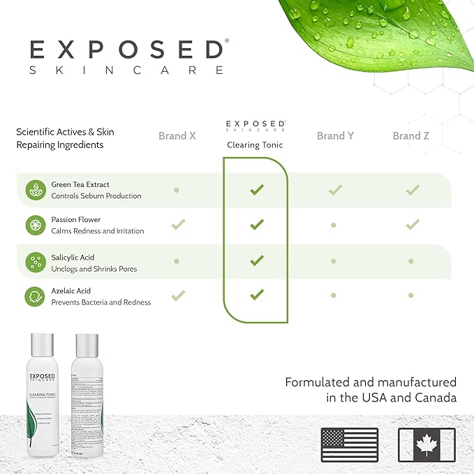 Exposed Skin Care Clearing Tonic Facial Toner with 1% Salicylic Acid and Witch Hazel for Acne Treatment – Pore Minimizing Toner to Prevent Breakouts, Reduce Redness and Balance Skin – Step 2 (4 fl oz)-BrightBean Baby