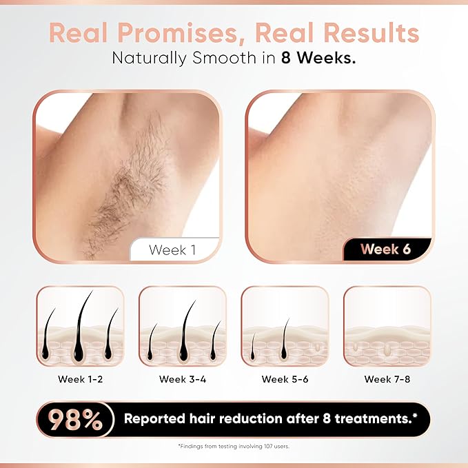 Sensica Cordless SensiLight PRO Rechargeable RPL Hair Removal Device – Permanent IPL for Women and Men – Painless, Unlimited Flashes, Wireless at-Home Body & Facial Hair Remover – XL Window 1.4x0.5-BrightBean Baby