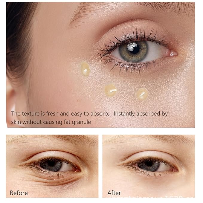 Retinol Eye Serum Anti Aging Under Eye Cream Visibly Reduces Wrinkles Fine Lines in 4-8 Weeks - Tightening Firming with Double Retinol 30ml-BrightBean Baby