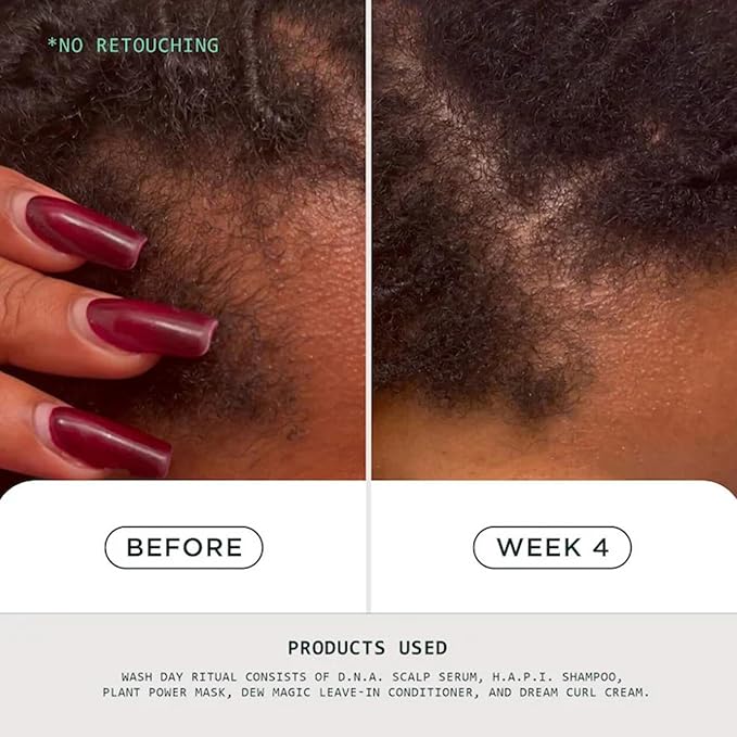 Sienna Naturals - D.N.A. Scalp Serum – Hair Growth Serum for Thinning Hair, Scalp Repair & Strength – Nourishing, Active Treatment for Scalp Health with Biotin & Rosemary– 1 oz-BrightBean Baby