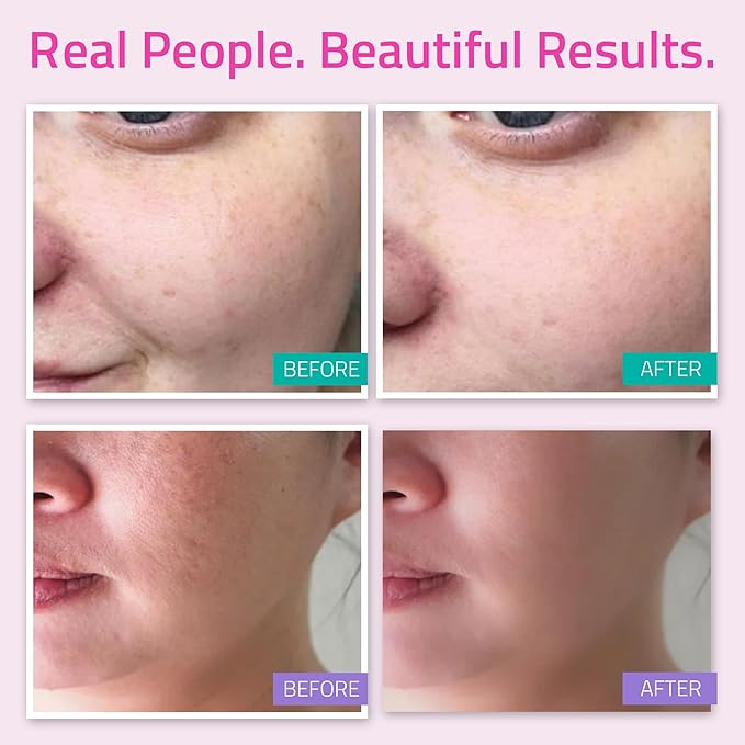 YEOUTH Skin Care Set: Hyaluronic Acid Serum for Face, Vitamin C Facial Serum, Face Cleanser, Toner & Cream, Hydrating Skin Care Kit 5-Piece-BrightBean Baby