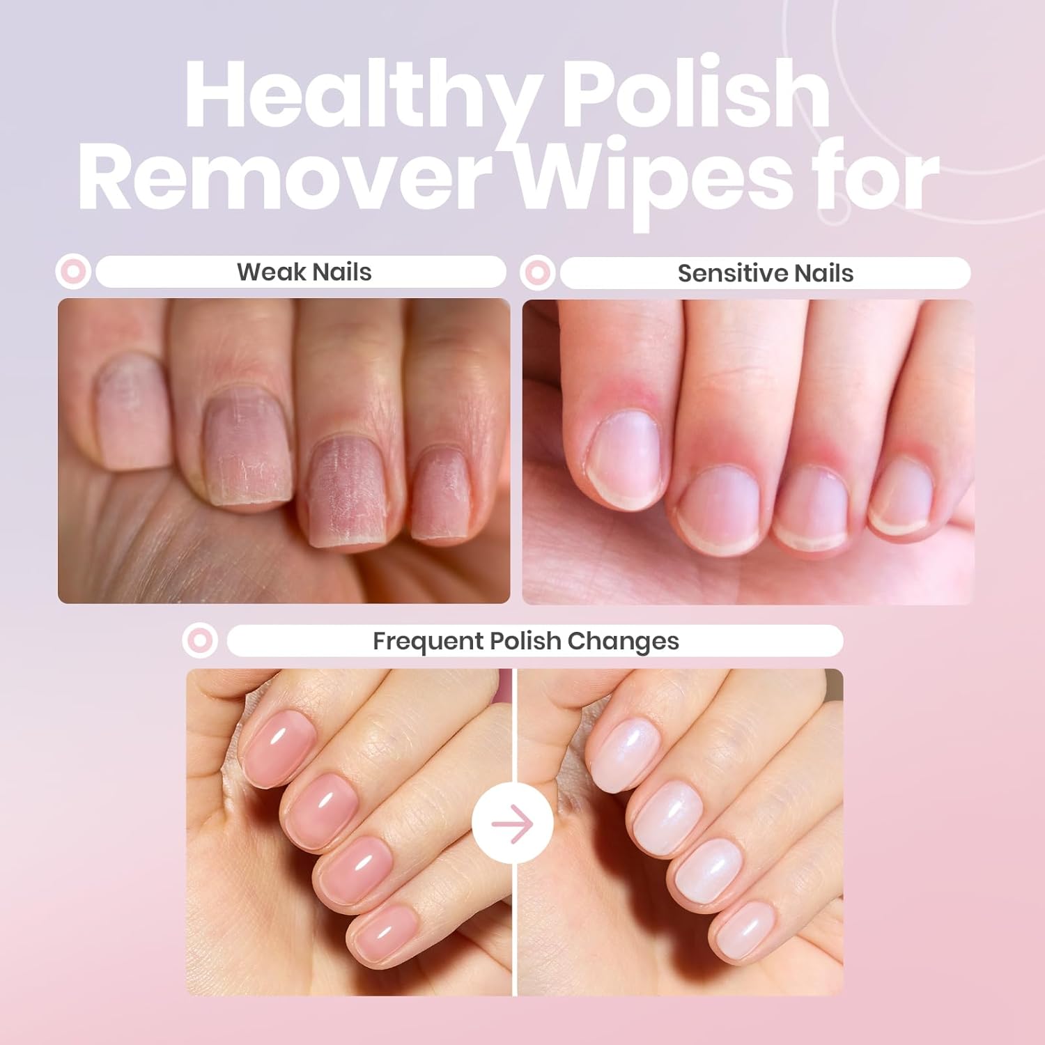 Beetles Non Acetone Nail Polish Remover - 0.67Fl Oz/20ML Nourishing Formula Acetone Free Nail Polish Remover - Non-Drying - Professional Quick and Gentle Removal for Natural Damaged Nails-BrightBean Baby