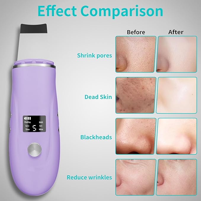 Skin Scrubber Facial Spatula - 4-in-1 Deep Cleansing Tool for Pore Extraction, Fast Charging Dock Blackhead Remover Face Spatula for Facial Skincare Women Gift (Purple)-BrightBean Baby