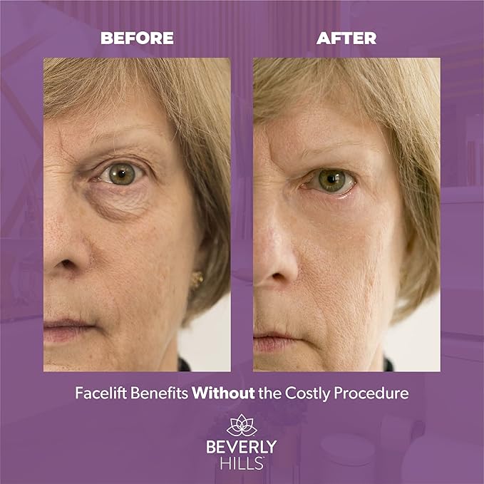 Beverly Hills V-Lift Instant Eye Lift and Eye Tuck Bee Venom Serum for Puffy Eyes, Dark Circles, Wrinkles, and Under Eye Bags Treatment for Women and Men | 30mL (120 Day Supply)-BrightBean Baby