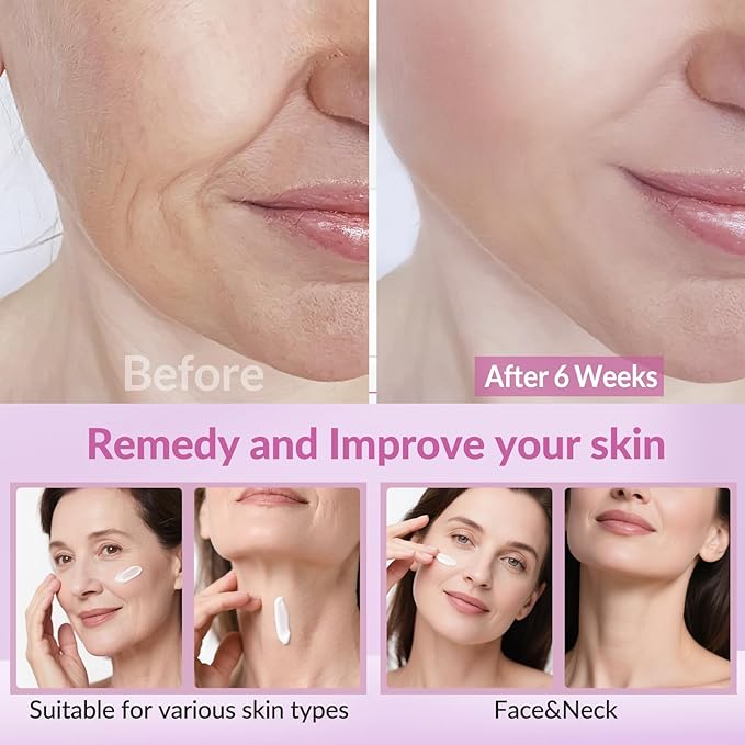 Neck Firming Creams for Tightening and Firming, Moisturizer Face Cream with Collagen, Hyaluronic Acid, Day & Night Anti-Aging Skin Tightening Cream Neck, Décolleté & Face – 1.7Fl Oz-BrightBean Baby
