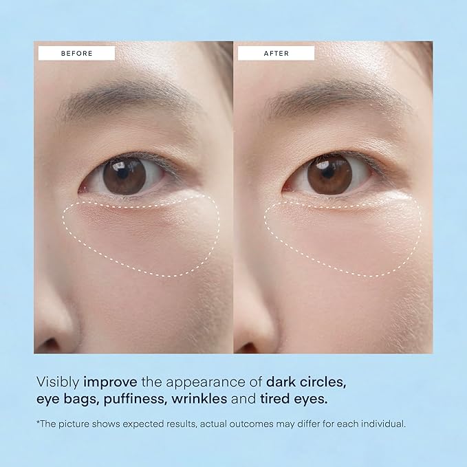 TEREZ & HONOR Under Eye Patches for Dark Circles - 60 Korean Hydrogel Masks for Puffiness, Bags with Caffeine, Hyaluronic Acid, Niacinamide - Undereye Brightening, Hydrating, Anti-Wrinkle & Cooling-BrightBean Baby