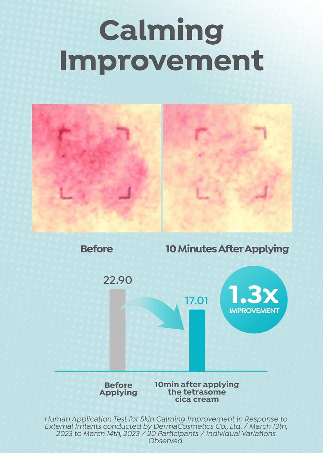 A'PIEU MADECASSOSIDE TETRASOME CICA CREAM 4.06 Fl oz / 120ml - Upgraded Absorption, Enhanced Skin Barrier, Calming Effects - Centella Asiatica, Asiaticoside, Asiatic Acid-BrightBean Baby