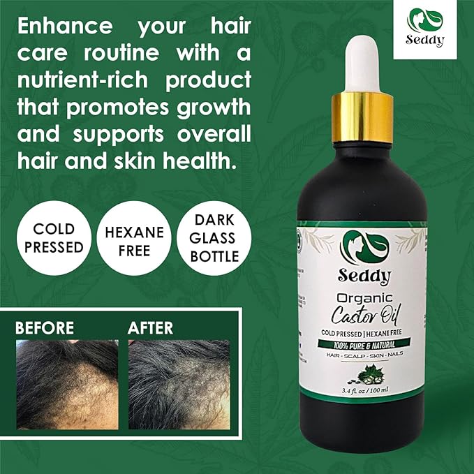 Seddy Organic Castor Oil - Cold Pressed | Hexane-Free | Pure | Hair, Scalp, Eyelashes, Eyebrows, Skin, & Nails | Hair Treatment Oil - 3.4 Fl. Oz-BrightBean Baby