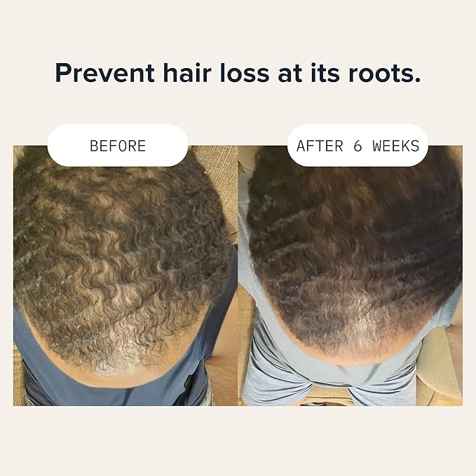 Hair Growth Conditioner for Men by CARDON, Prevent Thinning Hair and Hair Loss with Niacinamide & Vitamin B5 for healthy scalp, Korean Skin care, Deep Conditioner for dry damaged hair, (1 Bottle)-BrightBean Baby