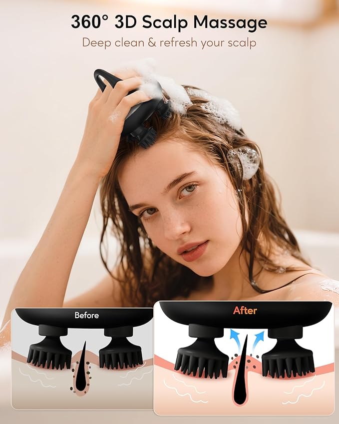 arboleaf Electric Scalp Massager Kneading Head Massager Scalp Stress Relax, Portable 6 in 1 Hair Massage with 12 Removable Massage Claws, Recharagable Head Stratcher, Gift for Mom Dad-BrightBean Baby