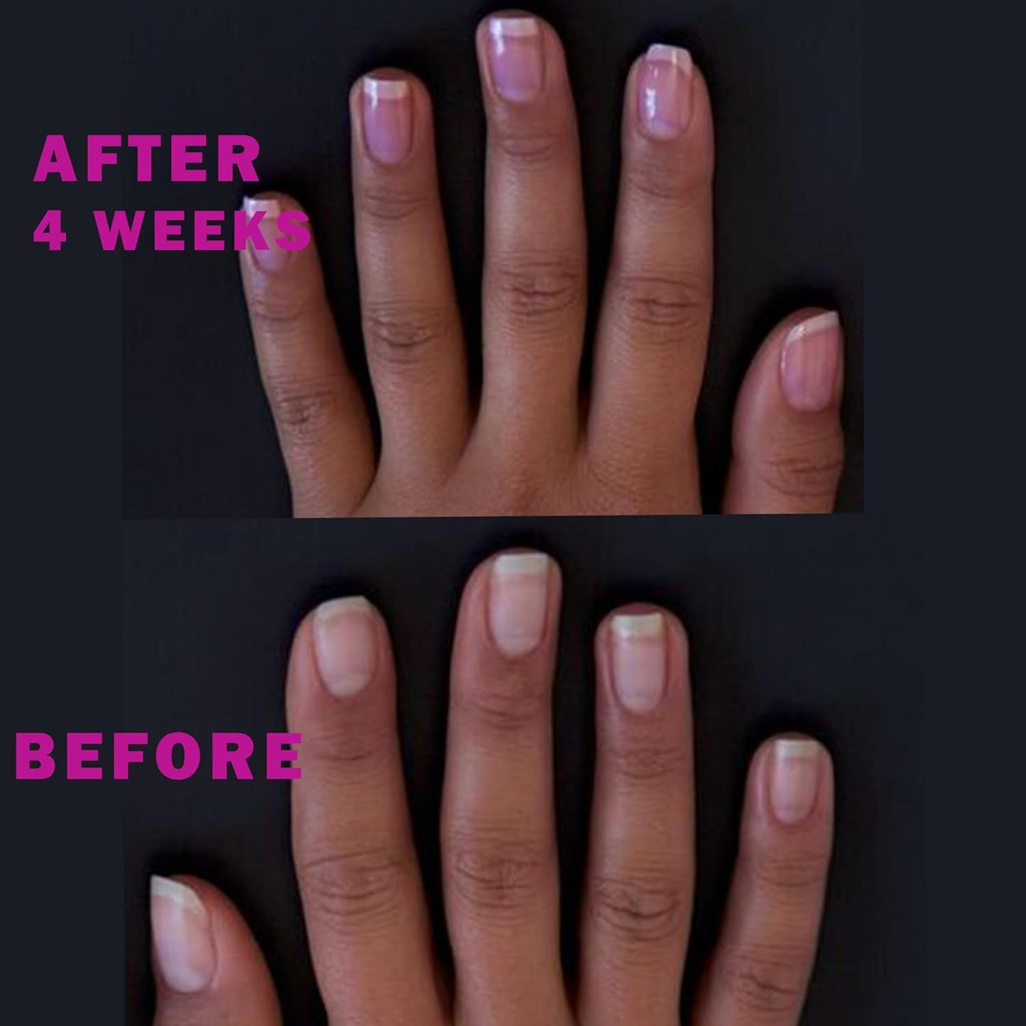 Perfect Formula Ruby Pink Gel Coat - Nail Strengthener, Keratin Nail Treatment, Gemstone Pink Gel Nail Polish - Nail Strengthener for Damaged Nails - Made In The USA .60 fl oz.-BrightBean Baby