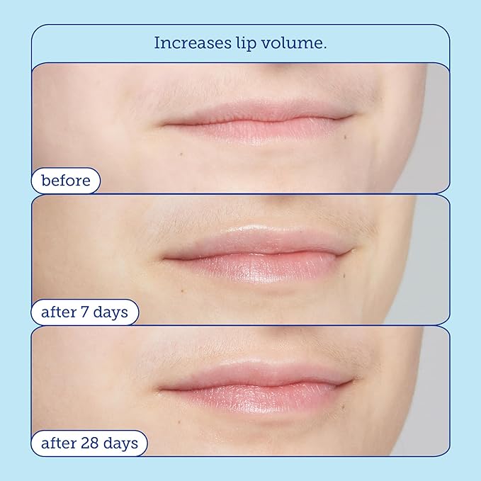 Skinfix Barrier+ Triple Lipid Lip Treatment: Nourish Dry, Chapped Lips With Our Volumizing Complex to Visibly Plump & Fill Fine Lines, 0.27 Oz-BrightBean Baby