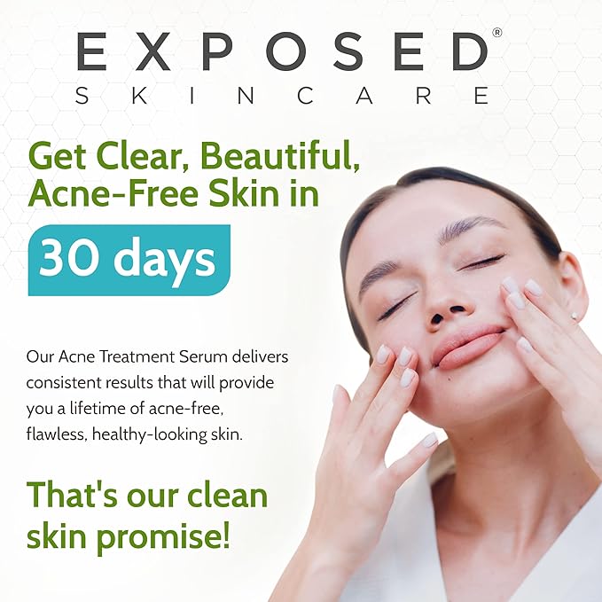Exposed Skin Care Acne Treatment Serum Step 3 – Quickly Reduces Pimple Size and Redness - 12 Hour Spot Treatment - 3.5% Benzoyl Peroxide, Natural Green Tea & Tea Tree Oil-BrightBean Baby
