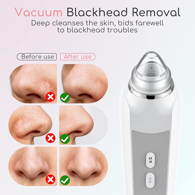 Blackhead Remover Vacuum, Black Head Remover for Face with Camera, Pore Vacuum for Men and Women, USB Interface Type Blackhead Remover Tools, 6 Suction Heads & 3 Adjustment Modes (Grey)-BrightBean Baby