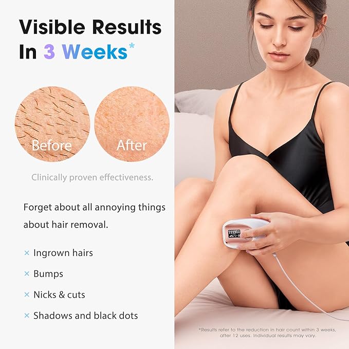 IPL Laser Hair Removal Device for Women & Men - Home 45°F Ice-Cooling Contact for Painless & Long-Lasting Results, 86% Hair Reduction in 3 Weeks for Full Body & Bikini Line, Rose Gold-BrightBean Baby