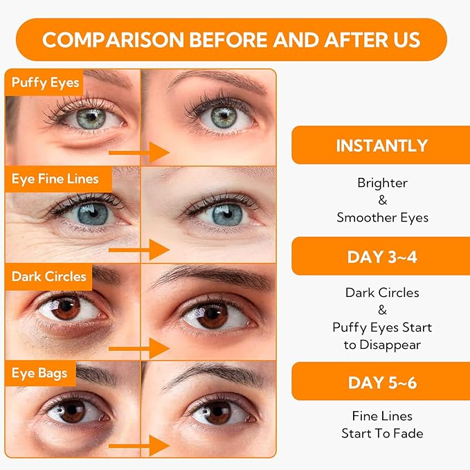 Vitamin C Under Eye Patches(30 Pairs) -Cooling Eye Masks for Dark Circles, with Caffeine Niacinamide Hydra-Gel Collagen, Puffy Eyes & Eye Bags Treatment, Fine Lines & Wrinkles Reduce, Anti-Aging-BrightBean Baby
