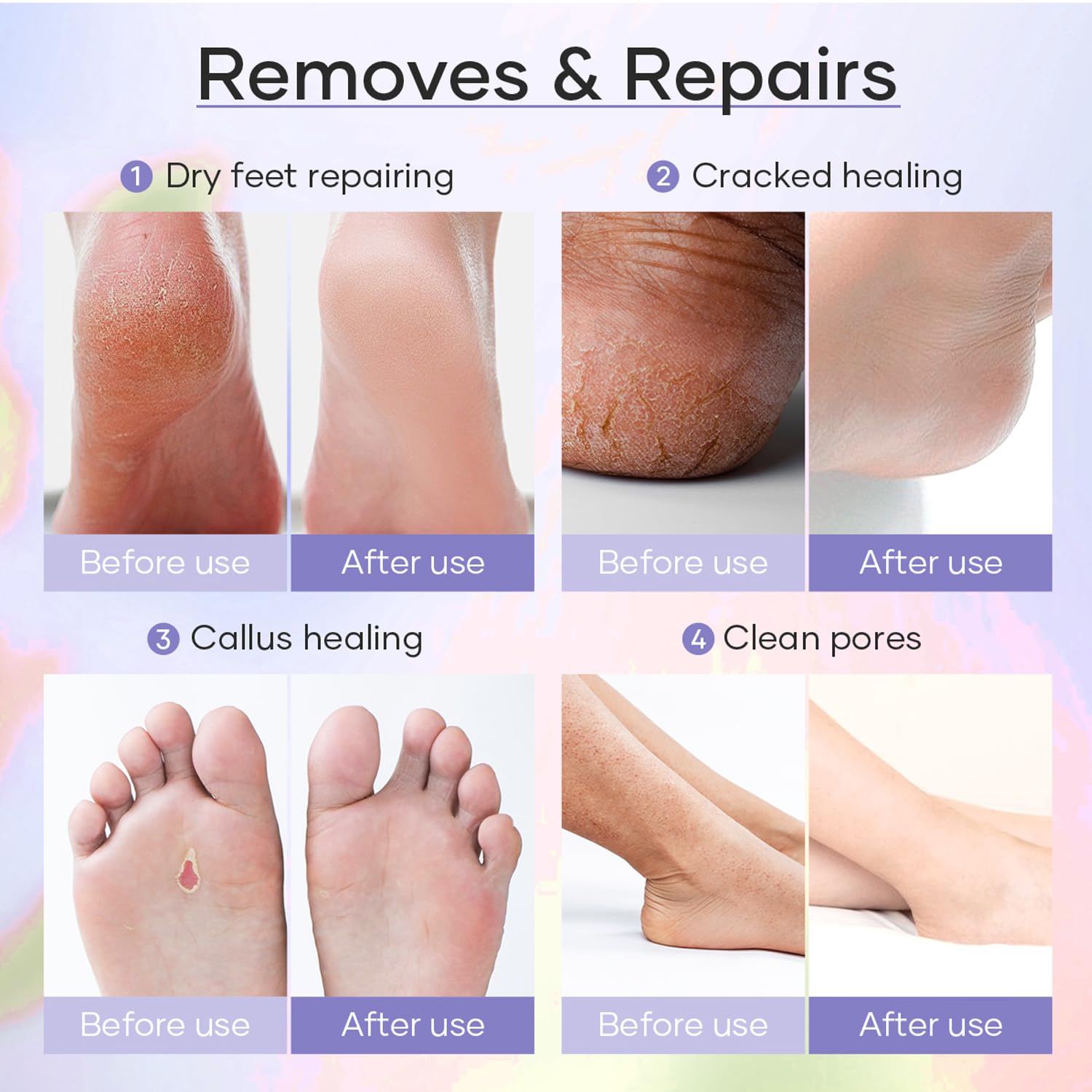 Epsom Salt Soak, Callus Remover Gel, Extreme Sugar Scrub, Collagen Mask & Shea Butter Lotion – Professional Spa Foot Care System 5 Step Luxury Pedicure Kit. Orange 03 Set-BrightBean Baby