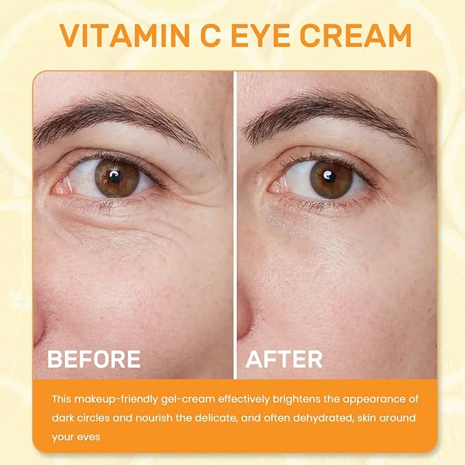 Vitamin C Eye Cream For Dark Circles, Under Eye Cream Anti Wrinkles For Reduce Puffiness And Bags Fine Lines, Wrinkles, Hydrating Eye Lifting Skin Care Anti Aging Eye Cream(0.7 FL.Oz)-BrightBean Baby
