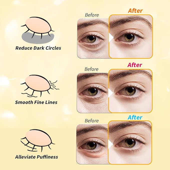 Under Eye Patches(12 Pairs), 24K Gold, Caffeine, Retinol Eye Masks for Puffy Eyes, Wrinkles, Dark Circles, Undereye Bags Treatment - Restoring & Awakening & Moisturizer Skin care Gift for Women-BrightBean Baby