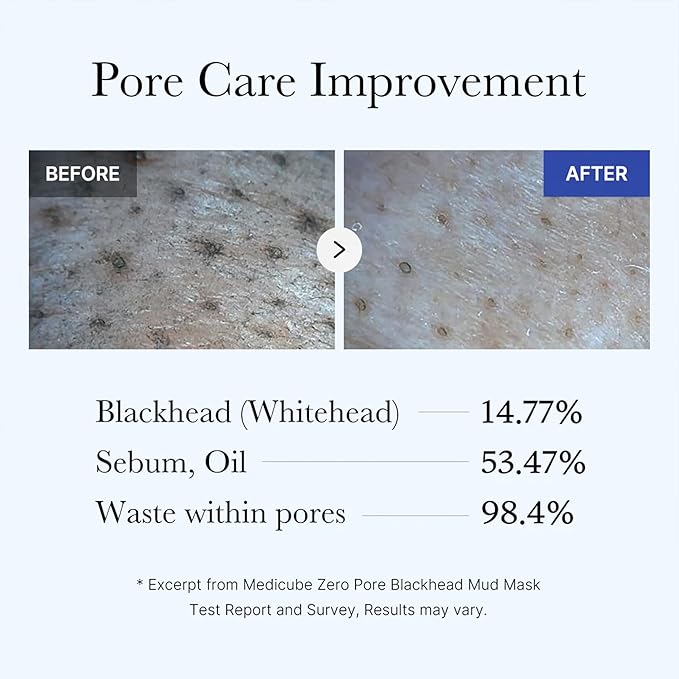 Medicube Zero Pore Blackhead Mud Facial Mask - Skin Cooling & Pore Tightening - 3 Minute Quick Dry Formula with AHA, BHA, PHA, and Pore-Purifying Clay - Korean Mud Mask 3.52 oz-BrightBean Baby