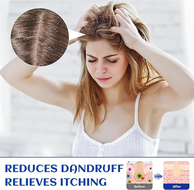 HIQILI 1000ML Rosemary Oil for Hair Growth, Add to Shampoo & Conditioner, 100% Pure Undiluted - 32 Fl Oz-BrightBean Baby