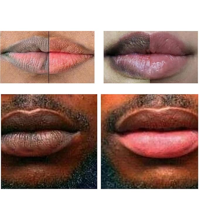 2pcs Lip Lightening for Dark Lips Lip Brightener for Smokers Dark Lip Treatment Lightening Cream for Pink Lips Lip Lightener for Smoker Lips Lip Lightening balm for Men and Women (Red)-BrightBean Baby