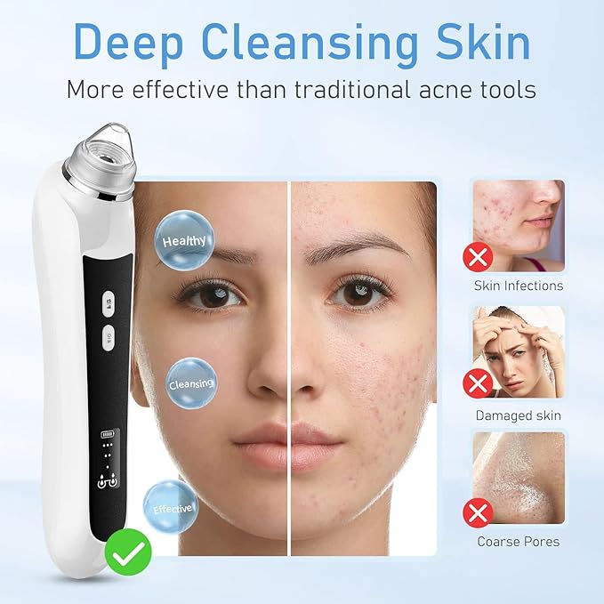 Facial Pore Blackhead Remover Vacuum, 1080P Camera Blackhead Remover, 20x Zoom, 8 LEDs ＆ 3 Suction Modes, 800mAh Battery & USB - 6 Heads Pore Cleaner Kit for Women&Men(Black)-BrightBean Baby