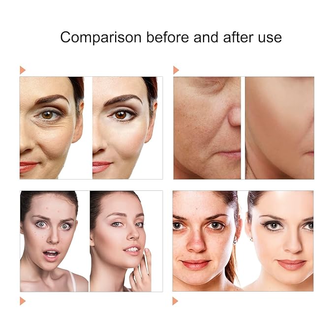 7 Color LED Face Mask LED Light Therapy Equipment for Skin Care at Home-BrightBean Baby