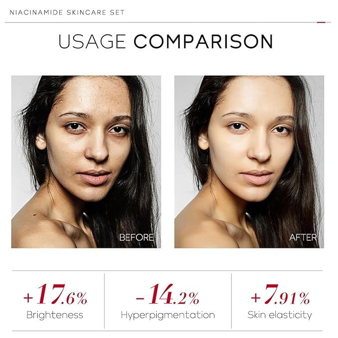 skin care set - skincare set for women - facial skin care sets & kits - gift set skincare - skin care sets for teens- skin care sets for men (ceramide)-BrightBean Baby