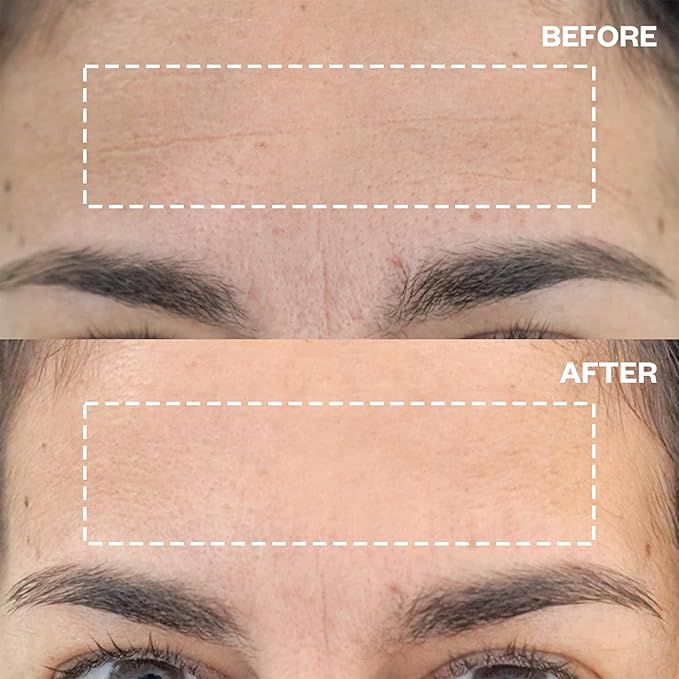 Wrinkles Schminkles Forehead Wrinkle Patches, 2-Pack, Reusable Hypoallergenic Silicone Smoothing Pads + Silicone Patch Cleanser 2 oz, Clean Silicone Patches Without Breaking Down The Adhesive-BrightBean Baby