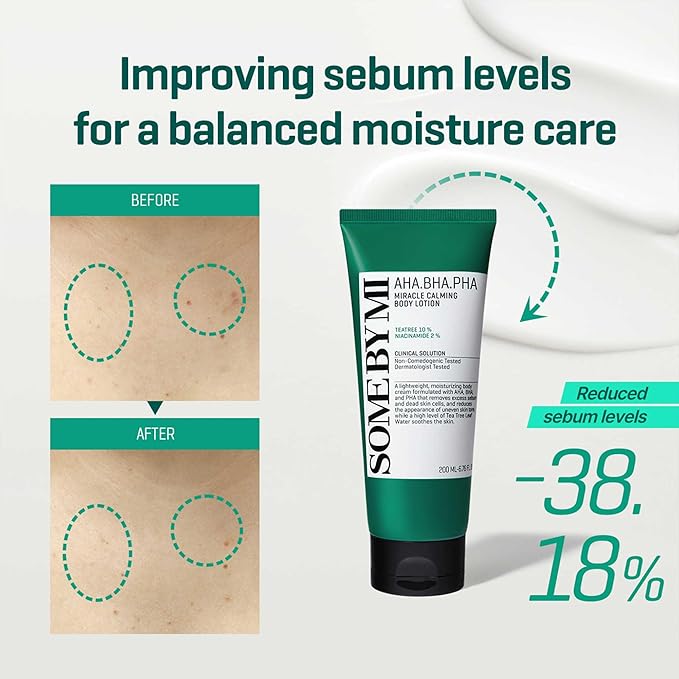 SOME BY MI AHA BHA PHA Miracle Calming Body Lotion – 6.76oz, 200ml – Korean Exfoliating Salicylic Acid Body Moisturizer for Dry Skin – Daily Hydration & Soothing Care with Centella – Korean Skin Care-BrightBean Baby