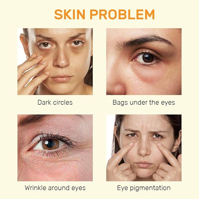 Vitamin C Eye Cream For Dark Circles, Under Eye Cream Anti Wrinkles For Reduce Puffiness And Bags Fine Lines, Wrinkles, Hydrating Eye Lifting Skin Care Anti Aging Eye Cream(0.7 FL.Oz)-BrightBean Baby