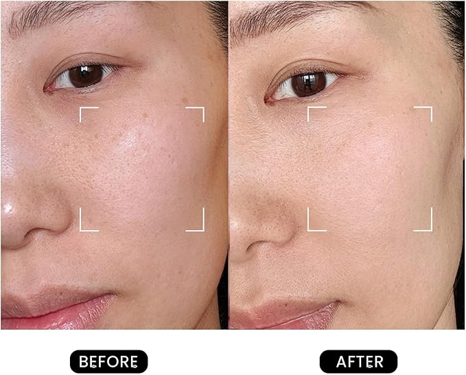 Revive Skincare for Anti-Aging, Glow Like Never Before,Multifunctional Beauty Device, Facial Massager for Home use-BrightBean Baby