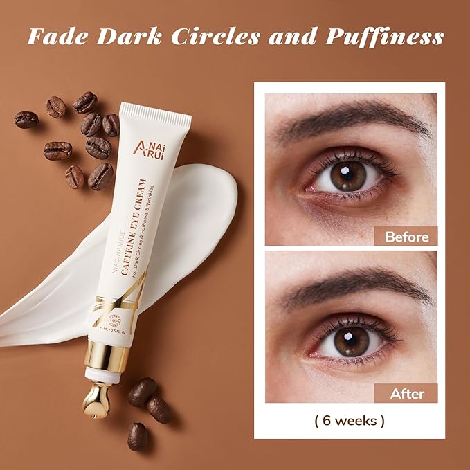 ANAI RUI Caffeine Eye Cream, Niacinamide Eye Cream for Dark Circles and Puffiness, Anti Aging & Friming Eye Cream with Eye Roller, Caffeine Under Eye Cream for Puffy Eyes, Bag Treatment 0.5 FL.OZ-BrightBean Baby