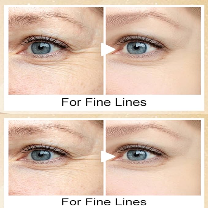 20g Eye Cream with Electric Massager, Moisturizing Anti-Wrinkles Eye Cream, Anti Aging Eye Cream for Dark Circles and Puffiness, Results in 3-4 Weeks to Reduce Fine Lines-BrightBean Baby