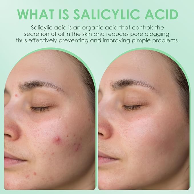 AUSLKA Salicylic Acid Oil Balancing Spray with 2% Salicylic Acid Regulates Skin Balance for Pimple and Oily Skin, Fruit Acid Spray for Face & Body (3.4 Fl Oz)-BrightBean Baby