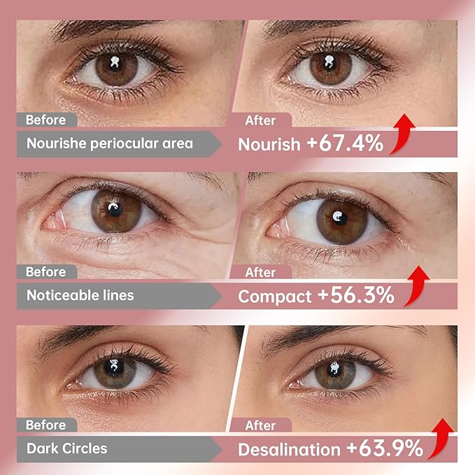 Novoy 15 Pairs Bio-Collagen Real Deep Eye Patches - 6-in-1 Retinol Overnight Eye Patches for Dark Circles, Puffiness & Wrinkles | 2% Caffeine/Hyaluronic/Niacinamide, Korean Popular Eye Mask - Lavender-BrightBean Baby