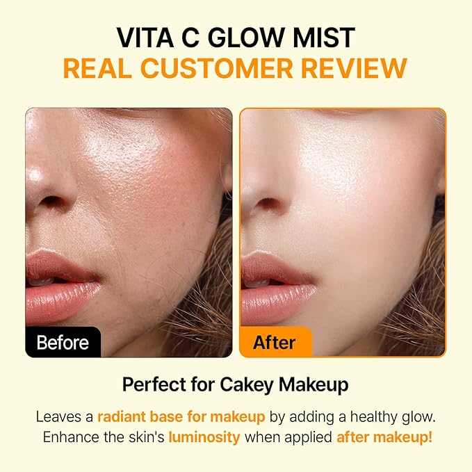 Vitamin C Mist with Niacinamide & Glutathione, Glow Mist for Dewy Skin, Makeup Setting Spray for face, Korean Skin Care, Vegan, 3.38 Fl Oz-BrightBean Baby