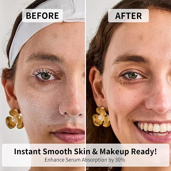 Face Razors for Women, Dermaplane Razor for Women Face, Eyebrow Razor, Facial Razors, Dermaplaning Tool, Reusable Metal Handle with 4 Microblades for Sensitive Skin, Peach Fuzz Remover, Green-BrightBean Baby