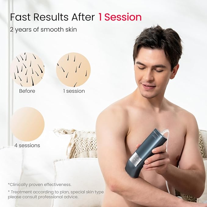 IPL Laser Hair Removal for Men, Dual Lights 100W, 35°F Sapphire Ice-Cooling, Quadruple-Pulse PHR Mode for Stubborn Hair, at Home Hair Removal Device for Armpits, Chest and Leg-BrightBean Baby